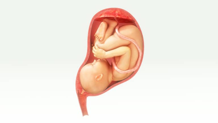 What is Placenta Previa & How Do You Treat It?