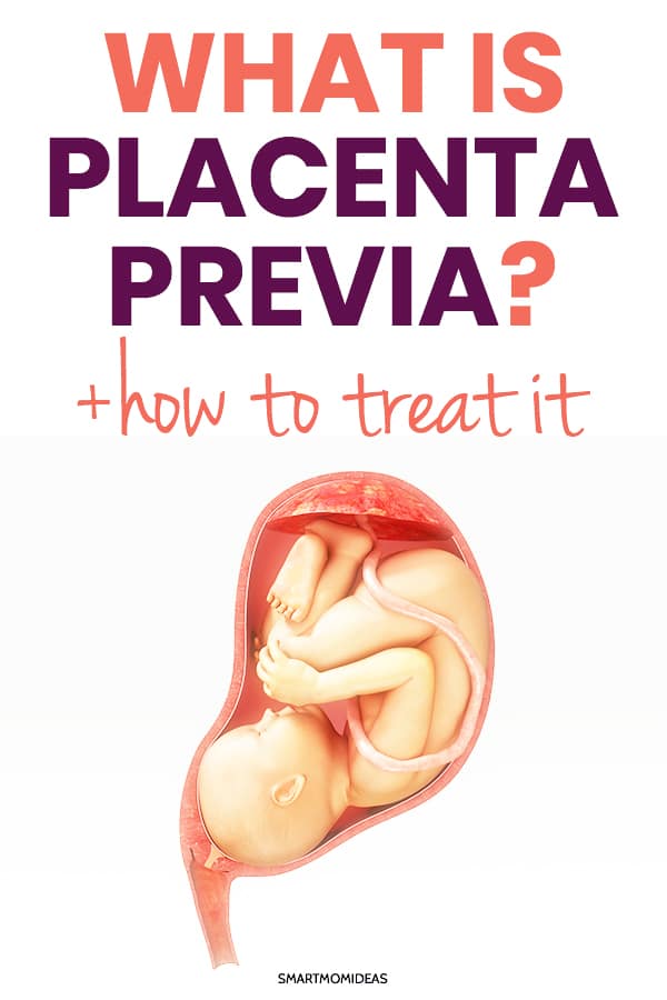 What is Placenta Previa & How Do You Treat It? | Smart Mom ...
